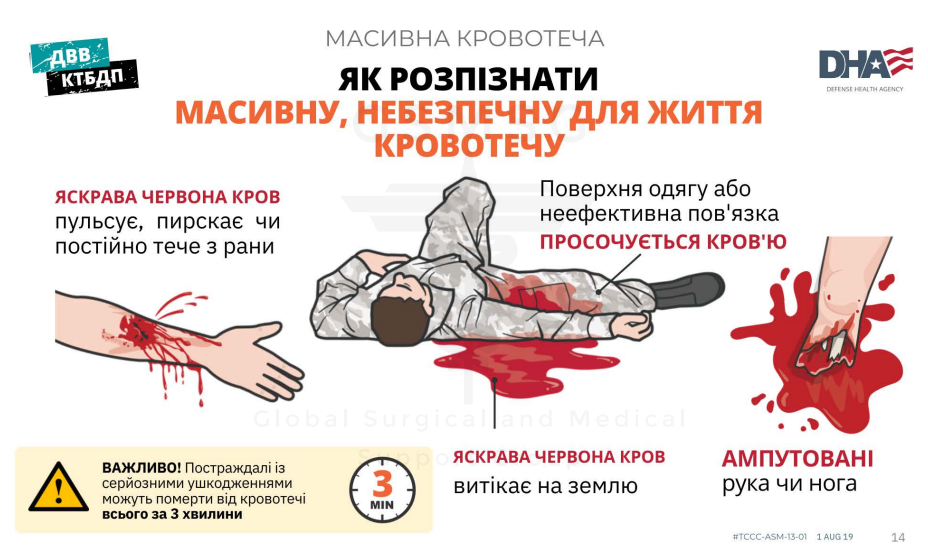 Перша медична допомога при кровотечах 