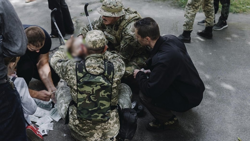 Дворічна дитина отримала травми обличчя та руки