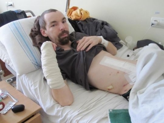 В лікарні Олегу зробили декілька операцій